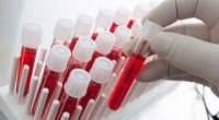 Аналіз крові на паразитів: які реакції організму лежать в основі тестів?
