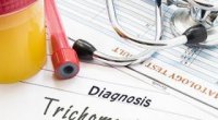 Трихомоніаз: симптоми у жінок, схема лікування, наслідки та профілактика