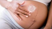 Що означає смужка на животі при вагітності?