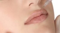 Антивіковий догляд: як прибрати зморшки над губами