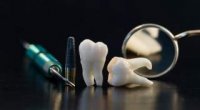 Видалення зуба мудрості на нижній щелепі: наслідки