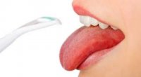Як почистити язик від нальоту і повернути йому здоровий вигляд?