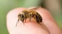 Що робити при укусах комах, як позбутися від алергії?