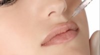 У яких випадках варто вдатися до контурної хірургічної пластики губ?