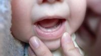 Чому виникає блювота при прорізуванні зубів у дітей?