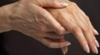 Шишка на руці під шкірою на зап’ясті: причини та лікування
