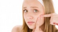 Вугровий висип на обличчі: причини і лікування