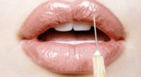 Як збільшити губи – домашні методи і косметичні процедури