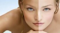 Бліда шкіра – генетична схильність і проблеми зі здоров’ям