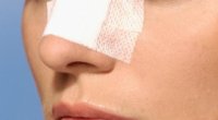 Викривлення носової перегородки: причини дефекту і способи його усунення