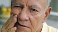 Невралгія лицьового нерва: симптоми і лікування