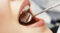 Як відбувається видалення зубного нерва в стоматологічній клініці?