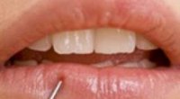 Причини оніміння губ: чи має місце патологічний процес?