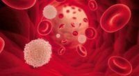 Низький рівень тромбоцитів у крові – причини, нормальний рівень, можливі наслідки