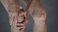 Хвороба гоффа – проблеми колінного суглоба