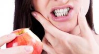 Як зняти чутливість зубів в домашніх умовах?